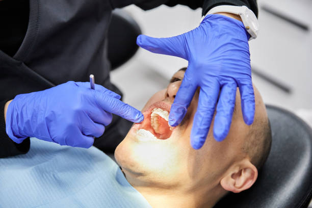 Best Dentist for Tooth Abscess  in South Fallsburg, NY