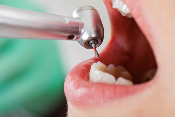 Best Cracked Tooth Emergency Dentist  in South Fallsburg, NY